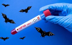 Bác sĩ bệnh viện tuyến đầu nói thẳng về virus Nipah