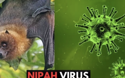 Nóng: Cục Quản lý Khám chữa bệnh (Bộ Y tế) ra thông báo khẩn về virus Nipah
