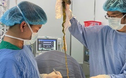 Bé trai phải lên bàn mổ vì ăn tóc, bác sĩ cảnh báo tình trạng y khoa hiếm gặp