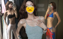 Phát sợ với cơ thể gầy trơ xương, héo mòn của con gái "nữ diễn viên quốc dân"