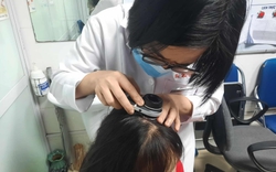 Mỗi ngày, một Bệnh viện tuyến Trung ương tiếp nhận cả trăm ca rụng tóc: Khi nào là dấu hiệu bệnh lý?