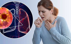 9 dấu hiệu ung thư phổi giai đoạn đầu thường bị bỏ qua