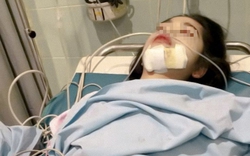 Ngày càng có nhiều người chết vì ung thư vòm họng? Bác sĩ cảnh báo: Có 5 nhóm người bị liệt vào danh sách "RỦI RO CAO"