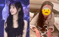 Gương mặt ngày càng biến dạng đến đáng sợ của Trịnh Sảng