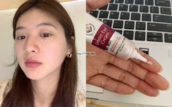 5 kem mắt bình dân giúp "là phẳng" nếp nhăn và mờ thâm thấy rõ