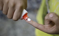 Bộ Y tế đình chỉ lưu hành, thu hồi toàn quốc loại kem bôi da do tên gây hiểu nhầm là thuốc