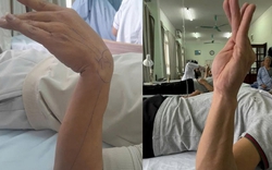 Ngủ gật 30 phút trong giờ làm, người đàn ông 37 tuổi bỗng liệt dây thần kinh, không nhấc nổi cổ tay