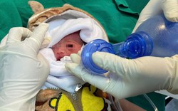 Giành giật sự sống cho trẻ sinh non chỉ nặng 900 gram