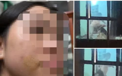 Xác minh vụ việc bé gái bị mẹ kế bạo hành ở Phú Thọ