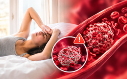 4 dấu hiệu cảnh báo máu có thể quá đặc, tăng nguy cơ hình thành cục máu đông