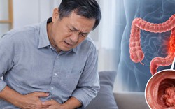 Bác sĩ chỉ: 6 DẤU HIỆU cảnh báo ung thư ruột, nhiều người nhầm tưởng là "rối loạn tiêu hóa"
