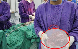 Bụng to bất thường, người đàn ông sốc khi bác sĩ gắp ra thứ "đáng sợ" nặng 2kg bên trong