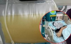 Người phụ nữ 38 tuổi đau bụng dữ dội, máu trắng đục như sữa, bác sĩ cảnh báo nguyên nhân từ thói quen ăn uống quen thuộc