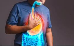 Lo âu và nguy cơ trào ngược dạ dày thực quản