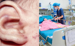 Bệnh do não mô cầu có tỷ lệ mắc thấp, tại sao vẫn dễ xảy ra bùng phát? Bác sĩ Bệnh viện Nhi Trung ương lý giải
