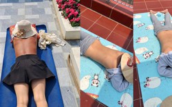 Cảnh báo nguy cơ sức khỏe từ trào lưu "phơi nắng giữa trưa"