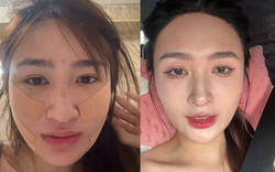Mỹ nhân SN 2001 đóng phim giờ vàng VTV công khai dung mạo sau khi hút mỡ mặt