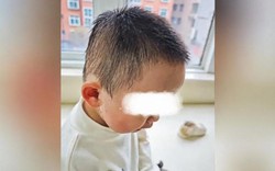 Bé trai 2 tuổi nuối nhầm viên giặt trong lúc mẹ đang nấu cơm