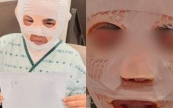 Chồng đổ nước sôi lên mặt vợ đang ngủ vì sợ vợ quen người đàn ông khác