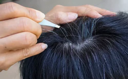 Lời khuyên cho những ai có tóc bạc sớm