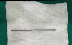 Bé trai 14 tuổi nhập viện vì dị vật dài 12cm trong niệu đạo