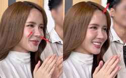 Gương mặt nhiều di chứng thẩm mỹ của Thiều Bảo Trâm đang khiến nhiều người lo lắng