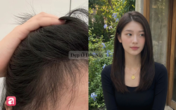 Tóc mọc tua tủa, chắc khỏe hơn nhờ 5 serum dưỡng thảo mộc vừa tốt vừa thơm rất dịu