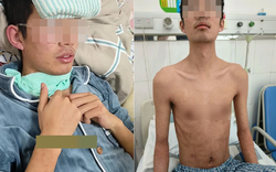 25 tuổi phát hiện ung thư gan giai đoạn cuối, bác sĩ xót xa nói 3 sai lầm đang âm thầm "hủy hoại" lá gan nhiều người mắc phải