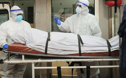 Virus Nipah tử vong tới 75%: Hướng dẫn điều trị mới nhất