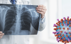 Viêm hô hấp cấp rình rập ngày Tết