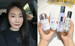 1 năm kiên trì dùng loại 4 serum dưỡng sáng này, nám má 2 bên của tôi đỡ hẳn