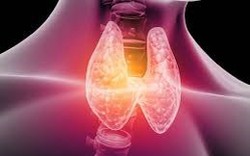 Nhiều người đi siêu âm phát hiện có nang giáp, bác sĩ chỉ ngay 5 dấu hiệu cảnh báo cần đi khám lại ngay lập tức