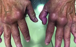 Nóng: Loại virus “phá hủy nội tạng” có thể chuẩn bị bùng phát