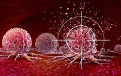 Ung thư rất ‘thích’ 2 loại thực phẩm này, chuyên gia cảnh báo: "Cần hạn chế ăn ngay lập tức"