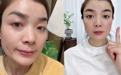 Ngoài 40 tuổi, tôi đã tìm ra cách "cải lão hoàn đồng", giúp da từ tổn thương tới khỏe đẹp mịn căng