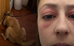 Bỏ 10 tỷ mua nhà, dọn vào ở được vài tháng, người phụ nữ mắc phải căn bệnh lạ khiến cơ thể biến dạng