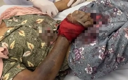 Uống thuốc dân gian sau khi bị rắn cắn, cụ bà 76 tuổi nguy kịch