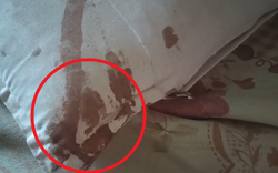 Nửa đêm tỉnh giấc, bé gái lớp 7 kinh hãi phát hiện vết máu loang trên gối: Thủ phạm nằm ngay trong nhà