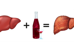 Bệnh gan tăng vọt sau Tết: Chuyên gia chỉ rõ thói quen "gánh nặng" nội tạng