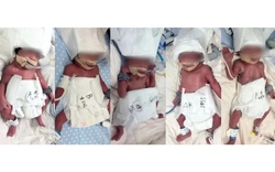 Người phụ nữ 24 tuổi sinh 5 hiếm gặp