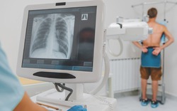 Chụp X-quang 'bấm là xong', sao phải chờ đủ 6 phút mới được BHYT thanh toán?