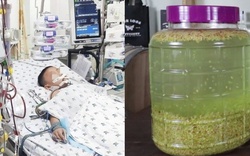 Bé 5 tháng tuổi tổn thương gan nghiêm trọng vì người lớn dùng đũa chấm vào rượu cho bé nếm thử
