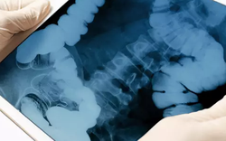 Cả bệnh viện hoảng loạn, sơ tán ngay lập tức vì điều này ở chàng trai 24 tuổi