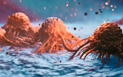 Những người dưới 50 tuổi chú ý: 6 triệu chứng này có thể là dấu hiệu của ung thư