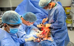 Bác sĩ TP HCM "giành lại" đôi chân cho thầy giáo Campuchia