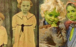 Bí ẩn về những "đứa trẻ da xanh": Lời giải nào cho hiện tượng kỳ quái bậc nhất trong lịch sử?