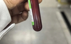 Mẹ bầu nghiện ăn gà rán, hamburger, tăng 5kg chỉ sau 1 tuần, cả mẹ lẫn con phải đi cấp cứu