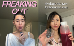 Bị đuổi việc, cô gái 27 tuổi để mặt mộc với mảng mụn lớn lên mạng tâm sự và cái kết bất ngờ