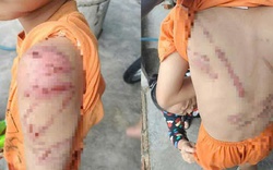 Lý do người cha đánh con 10 tuổi bầm tím khắp người