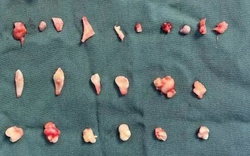 Cô gái đau bụng dữ dội, bác sĩ phát hiện ra bí mật bên trong